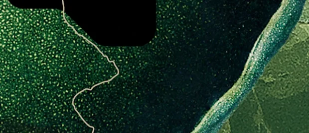 Resolving Abortions Guilt